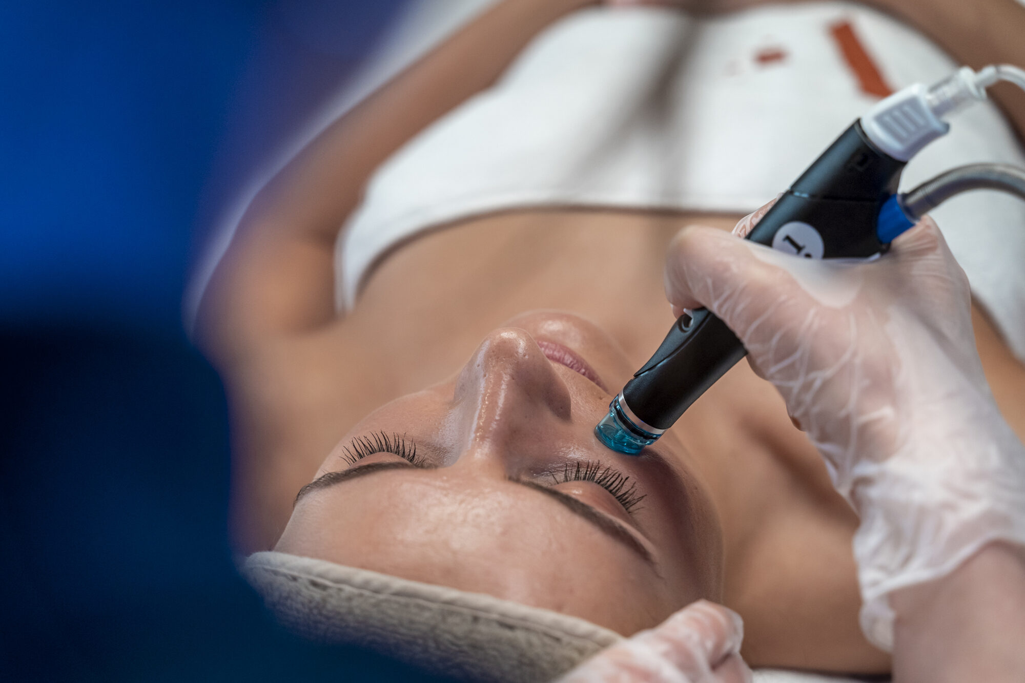 Hydrafacial treatment